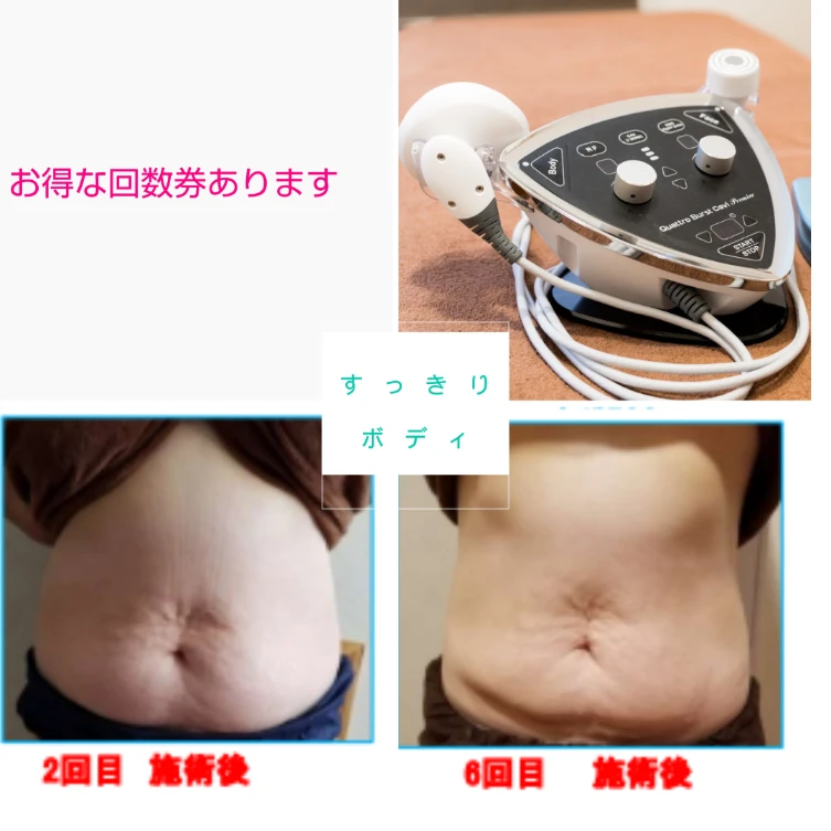 専門のエステティシャンによる施術